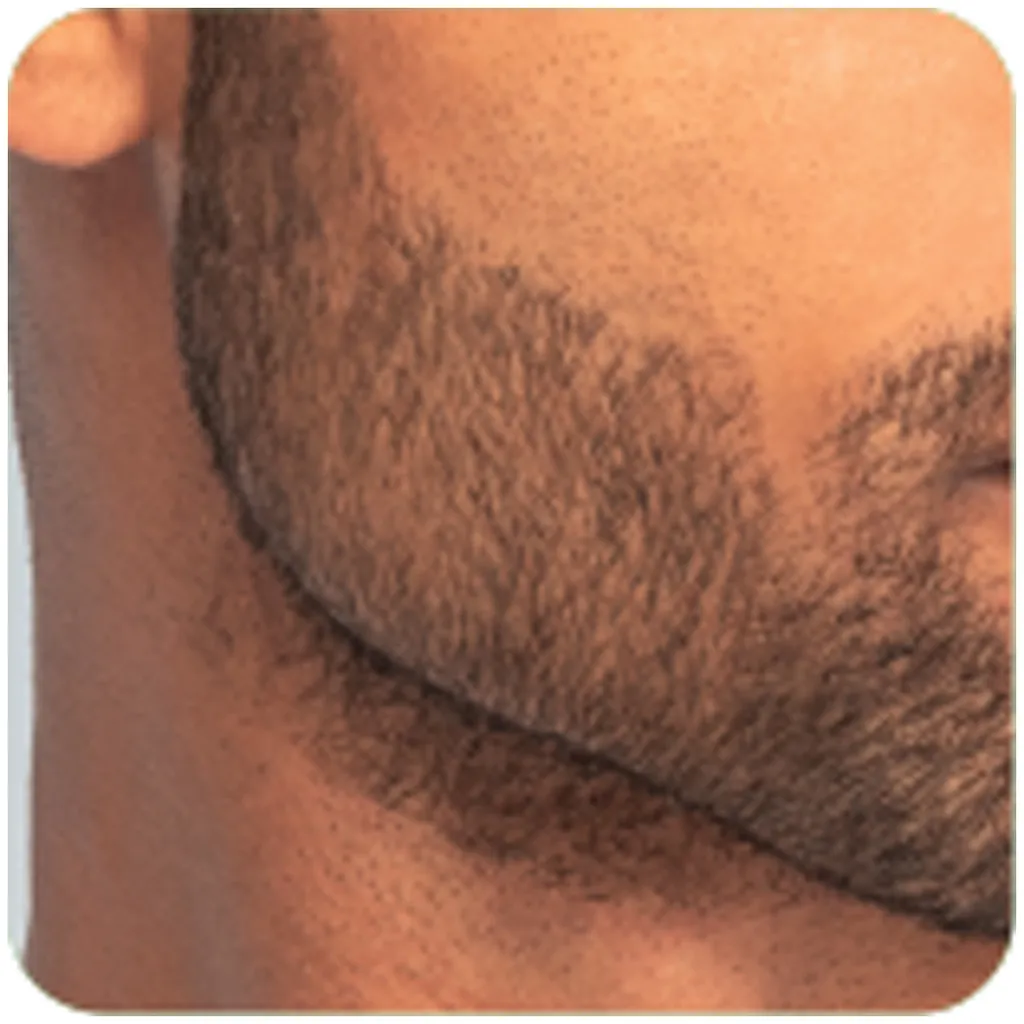 Remington regolabarba T-Series Ultimate Precision MB7000