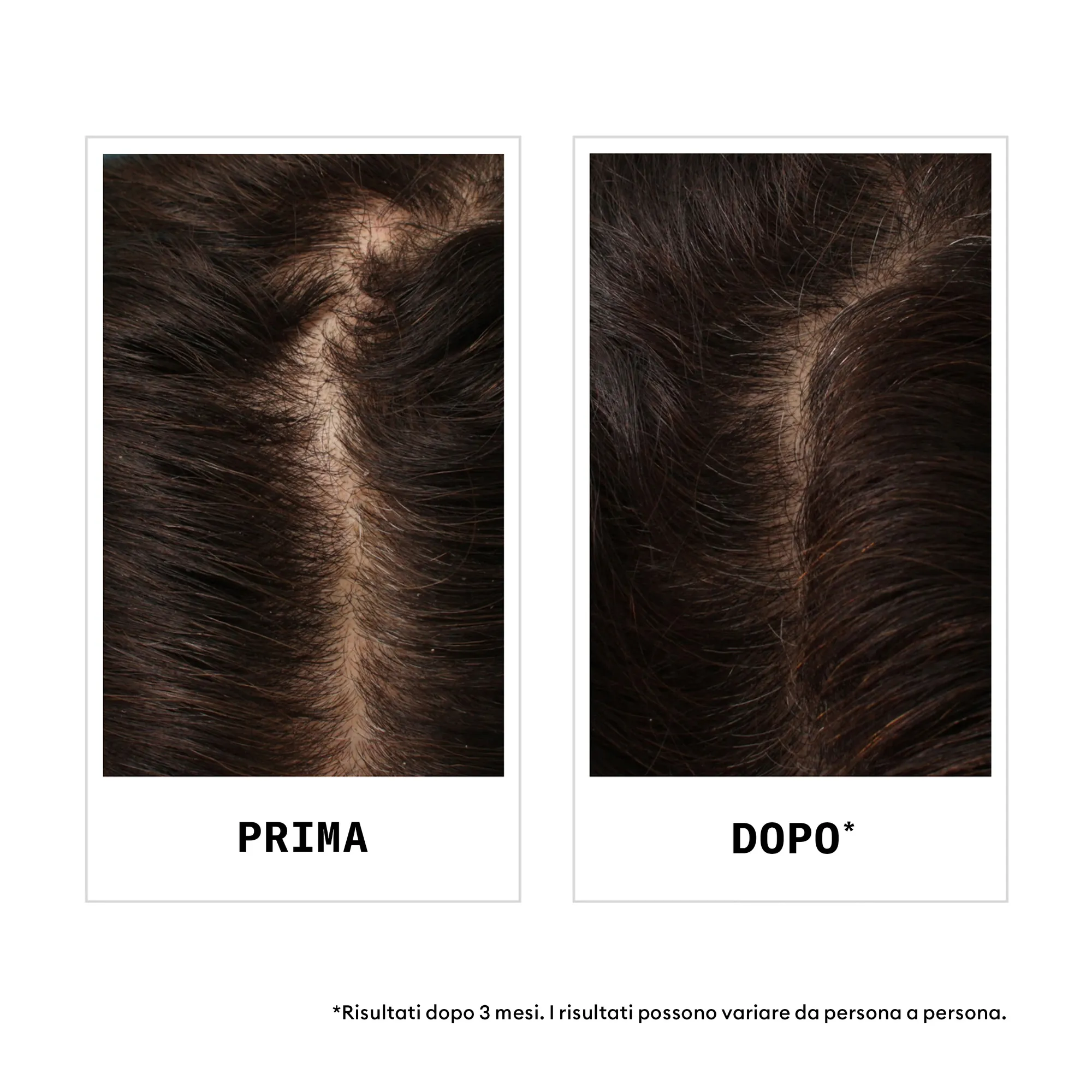 Nioxin Hair Fall Defense Shampoo